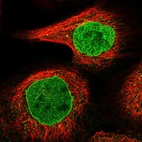 Immunofluorescent staining of human cell line A-431 shows localization to nucleoplasm & nuclear membrane.