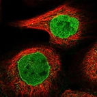 Immunofluorescent staining of human cell line A-431 shows localization to nucleoplasm & nuclear membrane.