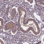 Anti-FRMPD1 Antibody