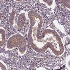 Anti-FRMPD1 Antibody