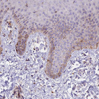 Immunohistochemical staining of human skin shows moderate to strong cytoplasmic positivity in basal epidermal cells (keratinocytes).