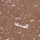 Immunohistochemical staining of human cerebral cortex shows moderate to strong cytoplasmic positivity in neuropil.