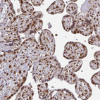 Immunohistochemical staining of human placenta shows strong nuclear positivity in trophoblastic cells.