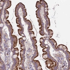 Immunohistochemical staining of human small intestine shows moderate to strong granular cytoplasmic positivity in glandular cells.