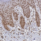 Immunohistochemical staining of human skin shows strong nuclear positivity in squamous epithelial cells.