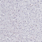Immunohistochemical staining of human liver shows no nuclear positivity in hepatocytes.