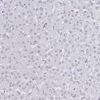 Immunohistochemical staining of human liver shows no nuclear positivity in hepatocytes.