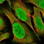 Immunofluorescent staining of human cell line U-2 OS shows localization to nucleus, nuclear membrane, cytosol & vesicles.