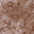 Anti-CHCHD3 Antibody