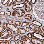 Immunohistochemical staining of human kidney shows strong granular cytoplasmic positivity in cells in tubules.