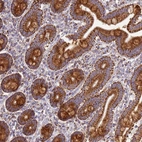 Immunohistochemical staining of human duodenum shows strong granular cytoplasmic positivity in glandular cells.