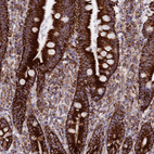 Immunohistochemical staining of human duodenum shows strong granular cytoplasmic positivity in glandular cells.