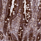 Immunohistochemical staining of human duodenum shows strong granular cytoplasmic positivity in glandular cells.