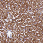Immunohistochemical staining of human liver shows moderate granular cytoplasmic positivity in hepatocytes.