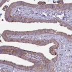Immunohistochemical staining of human fallopian tube shows moderate granular cytoplasmic positivity in glandular cells.