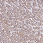 Immunohistochemical staining of human liver shows moderate granular cytoplasmic positivity in hepatocytes.