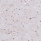 Immunohistochemical staining of human skeletal muscle shows weak granular cytoplasmic positivity in myocytes as expected.