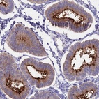 Anti-OR2AE1 Antibody