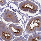 Anti-OR2AE1 Antibody