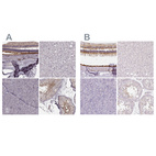 Anti-RPGRIP1 Antibody