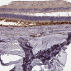 Immunohistochemical staining of human eye retina shows strong positivity in the photoreceptor layer.