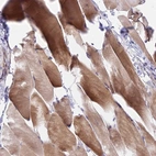 Anti-DUPD1 Antibody
