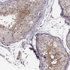 Immunohistochemical staining of human testis shows moderate positivity in late spermatids in seminiferous ducts.