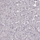 Anti-RPGRIP1 Antibody