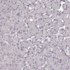 Immunohistochemical staining of human liver shows no positivity in hepatocytes as expected.