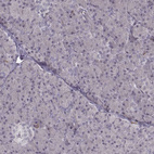 Immunohistochemical staining of human pancreas shows no positivity in exocrine glandular cells as expected.