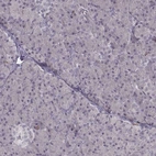 Immunohistochemical staining of human pancreas shows no positivity in exocrine glandular cells as expected.