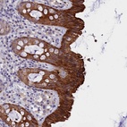 Anti-C16orf62 Antibody