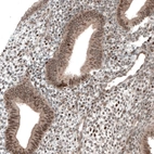 Immunohistochemical staining of human endometrium shows weak to moderate nuclear positivity in glandular cells.