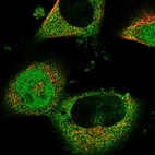 Immunofluorescent staining of human cell line U-251 MG shows localization to nucleoplasm, plasma membrane & cytosol.