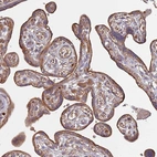 Immunohistochemical staining of human placenta shows moderate cytoplasmic positivity in trophoblastic cells.
