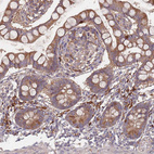 Immunohistochemical staining of human small intestine shows moderate to strong cytoplasmic positivity in glandular cells and lymphoid cells.