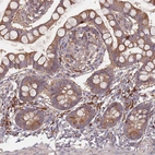 Immunohistochemical staining of human small intestine shows moderate to strong cytoplasmic positivity in glandular cells and lymphoid cells.