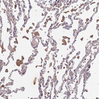 Immunohistochemical staining of human lung shows moderate cytoplasmic positivity in macrophages.