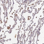 Immunohistochemical staining of human lung shows moderate cytoplasmic positivity in macrophages.