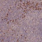 Anti-ATG5 Antibody