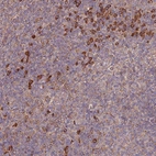Immunohistochemical staining of human tonsil shows moderate to strong cytoplasmic positivity in a subset of lymphoid cells.