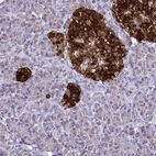 Anti-DPH6 Antibody