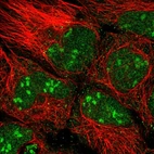 Immunofluorescent staining of human cell line HEK 293 shows localization to nucleus & nucleoli.