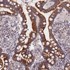 Anti-ECSIT Antibody