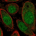 Immunofluorescent staining of human cell line PC-3 shows localization to nucleus & cytosol.