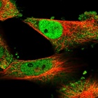 Immunofluorescent staining of human cell line U-251 MG shows localization to nucleoplasm & cytosol.