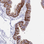 Immunohistochemical staining of human fallopian tube shows strong cytoplasmic positivity in glandular cells.