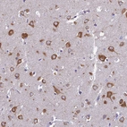 Immunohistochemical staining of human cerebral cortex shows strong cytoplasmic positivity in neurons.
