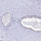 Immunohistochemical staining of human prostate shows no positivity in glandular cells as expected.