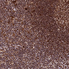 Anti-SF3B3 Antibody